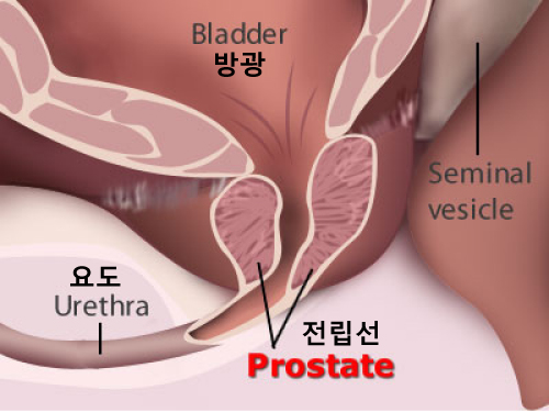 prostate.1.jpg